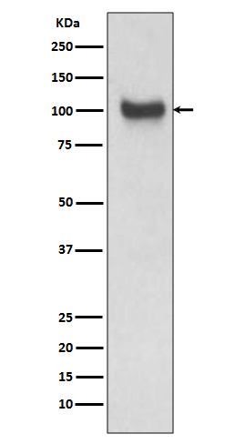 Rabbit Polyclonal Antibody to VCAM1