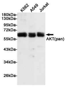 Rabbit Polyclonal Antibody to AKT