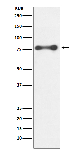Rabbit Polyclonal Antibody to PKC delta