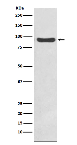 Rabbit Polyclonal Antibody to IKK beta