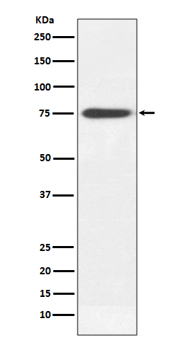 Rabbit Polyclonal Antibody to Human IgM