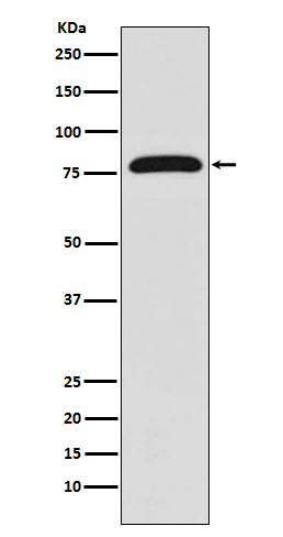 Rabbit Polyclonal Antibody to Transglutaminase 2