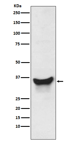 Rabbit Polyclonal Antibody to BNIP3L