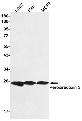 Rabbit Polyclonal Antibody to Peroxiredoxin 3