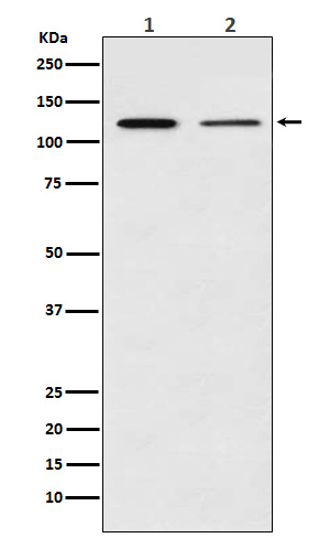 Rabbit Polyclonal Antibody to NF-KB p100