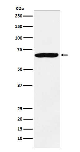 Rabbit Polyclonal Antibody to IMP3