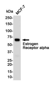 Rabbit Polyclonal Antibody to Estrogen Receptor alpha