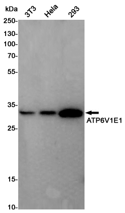 Rabbit Polyclonal Antibody to ATP6V1E1