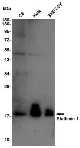 Rabbit Polyclonal Antibody to Stathmin 1