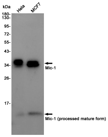 Rabbit Polyclonal Antibody to GDF15
