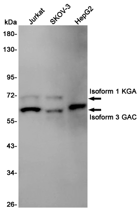 Rabbit Polyclonal Antibody to Glutaminase