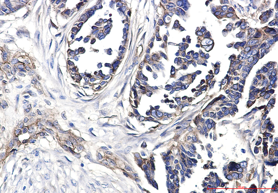 Rabbit Polyclonal Antibody to Integrin beta 1