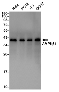 Rabbit Polyclonal Antibody to AMPK beta 1