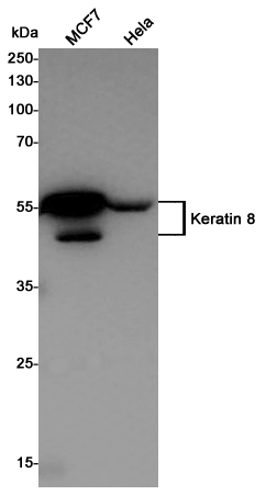 Rabbit Polyclonal Antibody to Cytokeratin 8