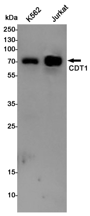 Rabbit Polyclonal Antibody to CDT1