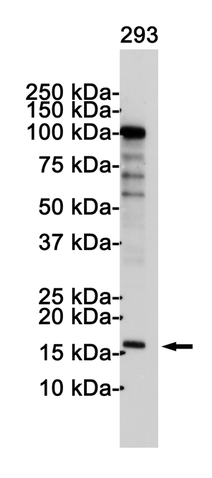 Rabbit Polyclonal Antibody to CDKN2A/p16INK4a