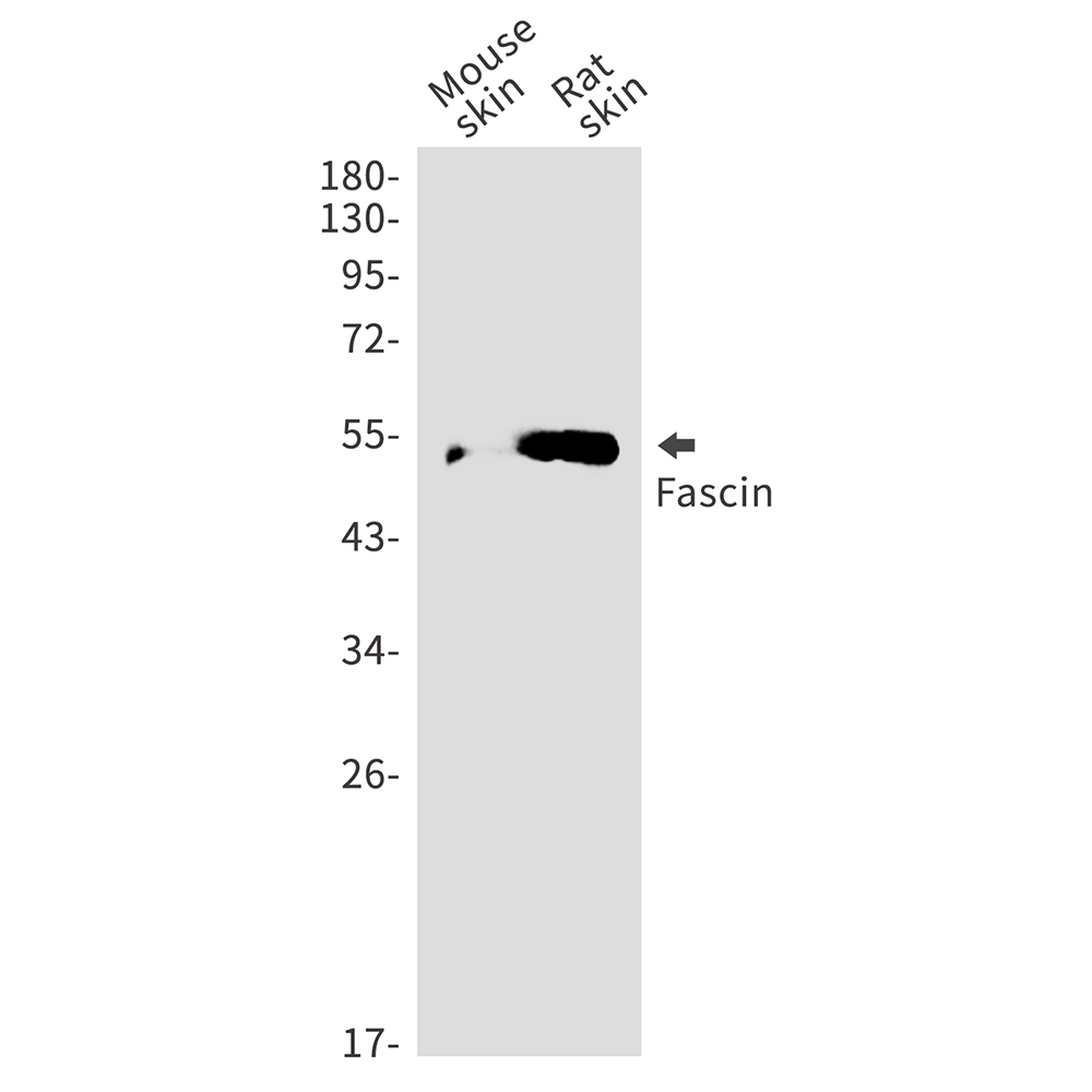 Rabbit Polyclonal Antibody to Fascin