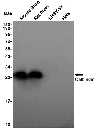 Rabbit Polyclonal Antibody to Calbindin