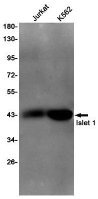 Rabbit Polyclonal Antibody to Islet 1
