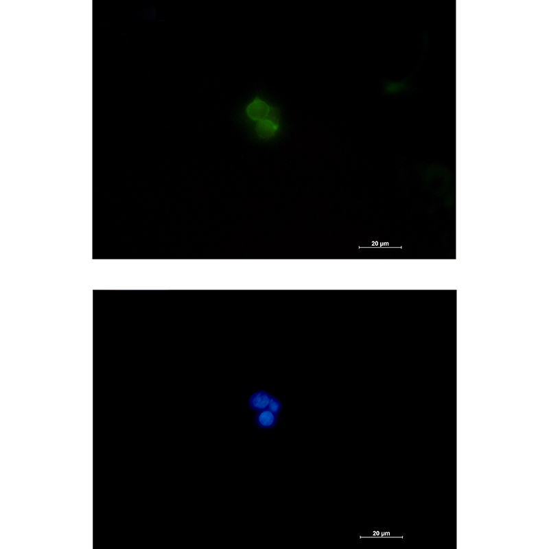 Rabbit Polyclonal Antibody to Plastin L