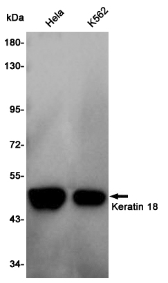 Rabbit Polyclonal Antibody to Cytokeratin 18