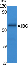 Rabbit Polyclonal Antibody to A1BG