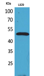 Rabbit Polyclonal Antibody to VEGFC