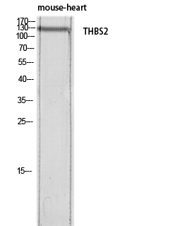 Rabbit Polyclonal Antibody to Thrombospondin 2