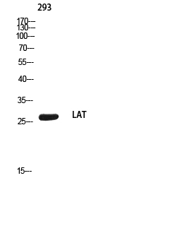 Rabbit Polyclonal Antibody to LAT