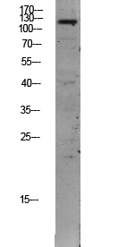 Rabbit Polyclonal Antibody to TIE2