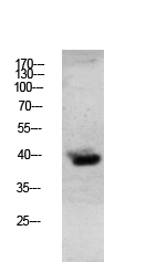 Rabbit Polyclonal Antibody to Granzyme B