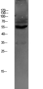 Rabbit Polyclonal Antibody to OAT1