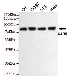 Rabbit Polyclonal Antibody to Ezrin