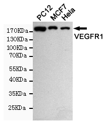 Rabbit Polyclonal Antibody to VEGF Receptor 1