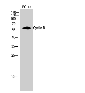 Rabbit Polyclonal Antibody to Cyclin B1