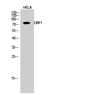 Rabbit Polyclonal Antibody to DRP1