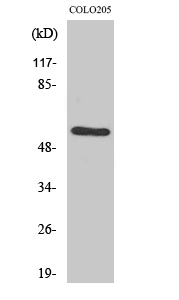 Rabbit Polyclonal Antibody to ER beta