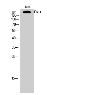 Rabbit Polyclonal Antibody to VEGF Receptor 2