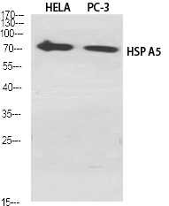 Rabbit Polyclonal Antibody to GRP78 BiP