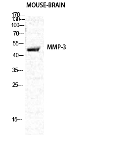Rabbit Polyclonal Antibody to MMP3