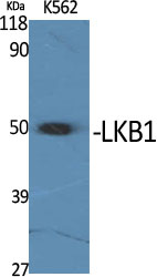 Rabbit Polyclonal Antibody to LKB1