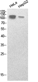 Rabbit Polyclonal Antibody to SREBP1