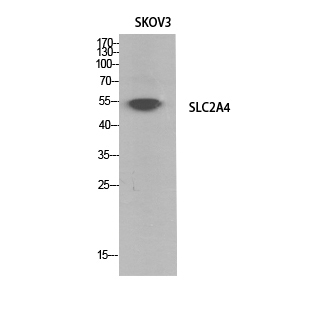 Rabbit Polyclonal Antibody to Glucose Transporter GLUT4