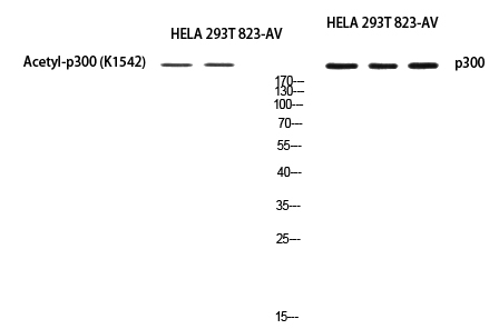 Rabbit Polyclonal Antibody to p300