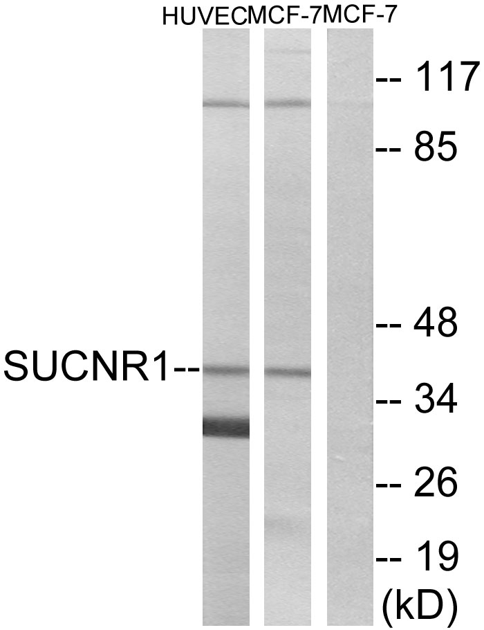 Rabbit Polyclonal Antibody to GPR91