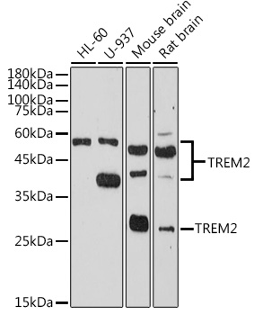 Rabbit Polyclonal Antibody to TREM2