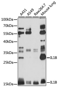 Rabbit Polyclonal Antibody to IL-1 beta