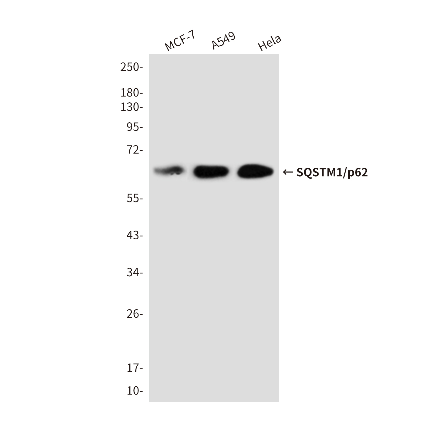 Rabbit Polyclonal Antibody to SQSTM1/p62