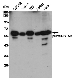 Rabbit Polyclonal Antibody to SQSTM1/p62