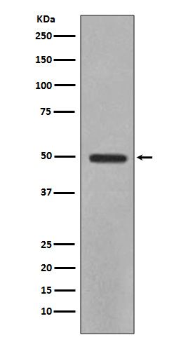 Rabbit Polyclonal Antibody to YB1